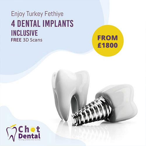 Implants Turkey